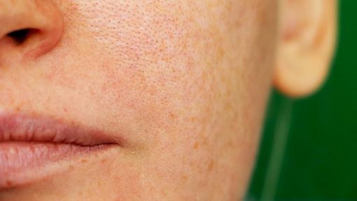 img-title 5 Rekomendasi Skincare untuk Mengecilkan Pori-Pori Wajah, Bikin Wajah Terlihat Mulus!