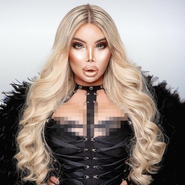 Ingin Bisa Hamil & Melahirkan, Transgender Ngotot Mau Transplantasi Rahim