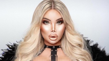 img-title Ingin Bisa Hamil & Melahirkan, Transgender Ngotot Mau Transplantasi Rahim