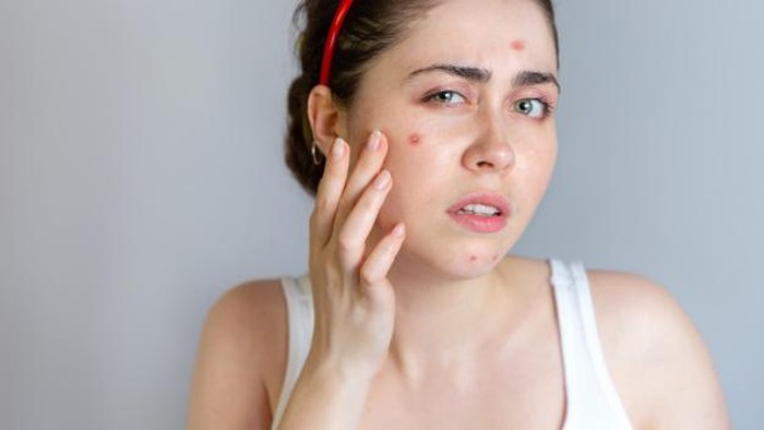 Pengaruhnya Besar Banget, Ini Tips dan Trik Memilih Face Wash Untuk Kulit Berjerawat Pengaruhnya Besar Banget, Ini Tips dan Trik Memilih Face Wash Untuk Kulit Berjerawat