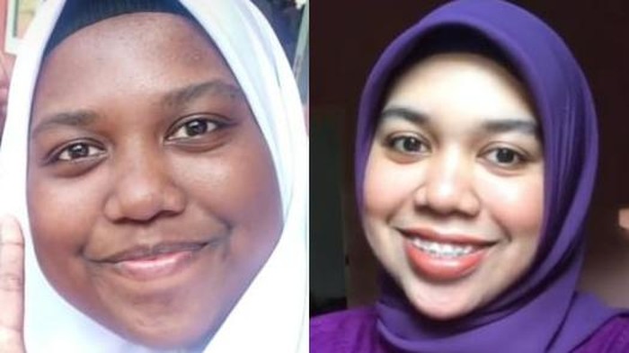 Dulu Diejek Kulitnya Gelap, Sekarang Wanita Ini Kulitnya Glowing Bikin Pangling!