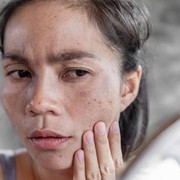 Ups! Ternyata Ini Penyebab Skin Barrier Kamu Rusak