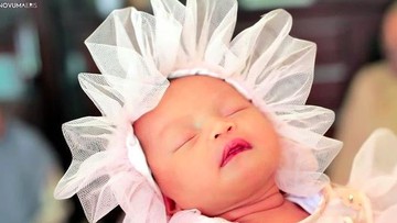 ANAK ZASKIA PERNAH LAHIR PREMATUR