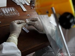 Batuk Pilek Dites Antigen Pasti Positif COVID-19? Ini Penjelasan Dokter Paru