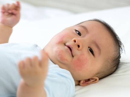 Ciri Bayi Alergi Makanan MPASI dan Jenis Penyebabnya