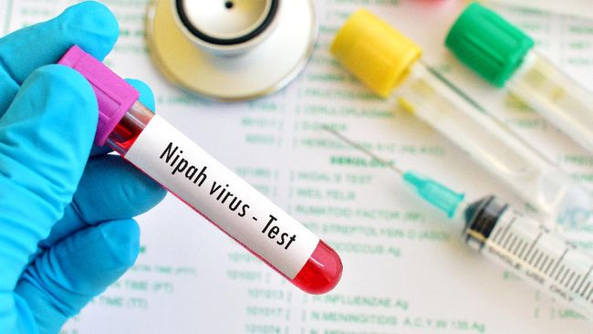Virus Nipah saat ini jadi perbincangan menyusul berita kematian dua warga India akibat virus tersebut. Seperti apa penularan virus Nipah dan cara mencegahnya?