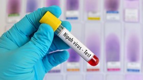 img-title Cara Penularan Virus Nipah yang Dikhawatirkan Jadi Pandemi