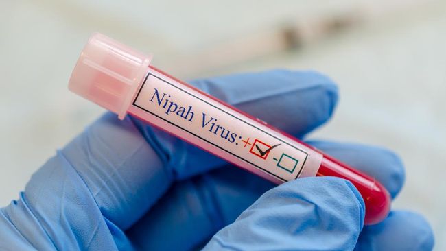 Virus nipah yang mulai merebak di India, ternyata pernah muncul di Indonesia, tetapi ditemukan pada kelelawar.