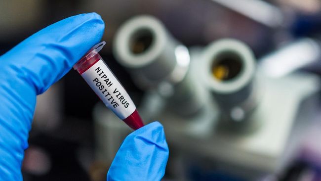 Virus Nipah bukan sekadar menyebabkan gejala ringan menyerupai influenza, melainkan dapat berkembang menjadi gangguan kesehatan fatal yang mengancam nyawa.