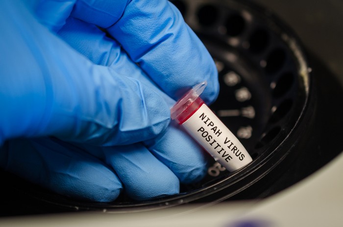 Scientist analyzing nipah virus positive blood sample