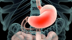 'Silent Reflux', Saat Asam Lambung Naik Diam-diam