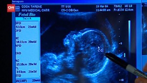 VIDEO: Bayi Dalam Rahim Kemungkinan Dapat Antibodi Covid-19