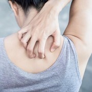 Back Acne Bikin Gak Pede? Yuk, Kenali Dulu Penyebab Munculnya!