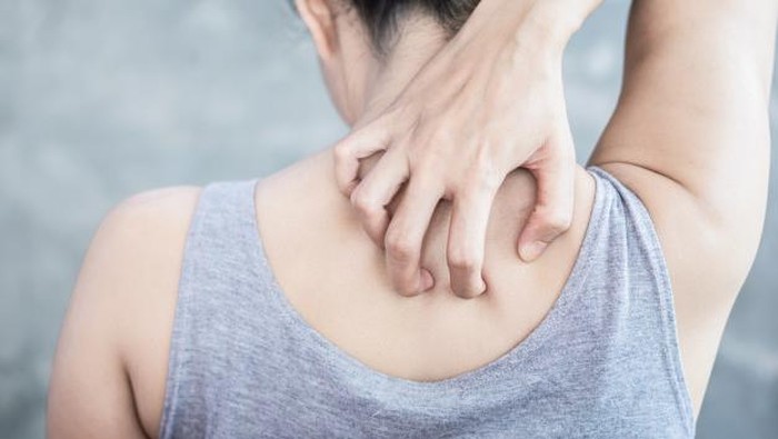 Back Acne Bikin Gak Pede? Yuk, Kenali Dulu Penyebab Munculnya!