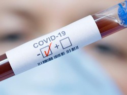 Viral Obat Cina COVID-19 Lianhua Qingwen Dilarang Beredar, Ini Penegasan BPOM