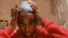 Pakai Lem Kayu untuk Rambut, Influencer AS Masuk RS