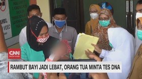VIDEO: Rambut Bayi Jadi Lebat, Orang Tua Minta Tes DNA