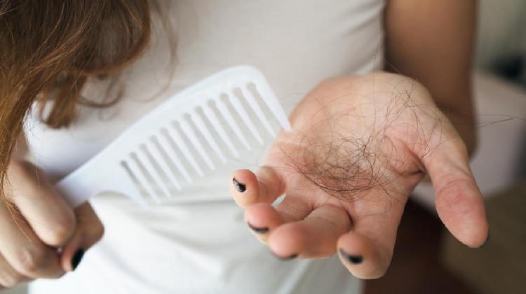 Woman losing hair on hairbrush in hand
