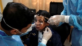 FOTO: 'Wajah Transparan' untuk Luka Bakar Bocah Gaza