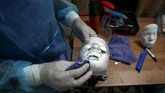FOTO: 'Wajah Transparan' untuk Luka Bakar Bocah Gaza Ahmed al-Deeb, bocah yang wajahnya mengalami luka bakar dipasangi masker transparan 3 dimensi di klinik MSF, Gaza, Palestina.