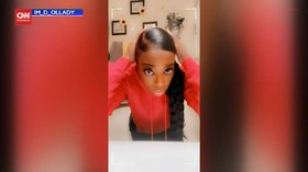 VIDEO: Influencer Dibawa ke RS Usai Pakai Lem Kayu di Rambut