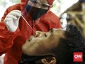 Alasan Hasil Tes Ulang Swab Covid-19 Beda Lab Bisa Berbeda