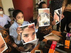 Bukti dari Nindy Ayunda Mampu Jadikan Suami Tersangka KDRT