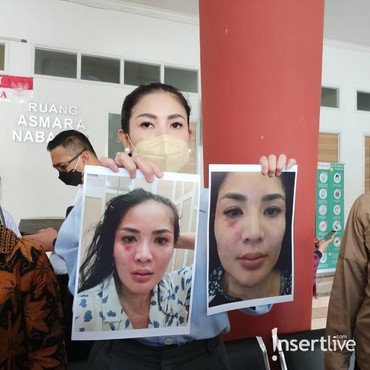 Resmi Cerai, Nindy Ayunda Dapat Hak Asuh Anak dari Askara