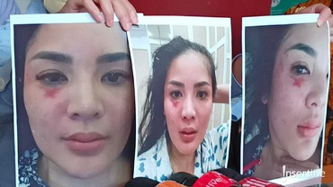 Ini Alasan Nindy Ayunda Baru Buka Suara Setelah 9 Tahun Alami KDRT