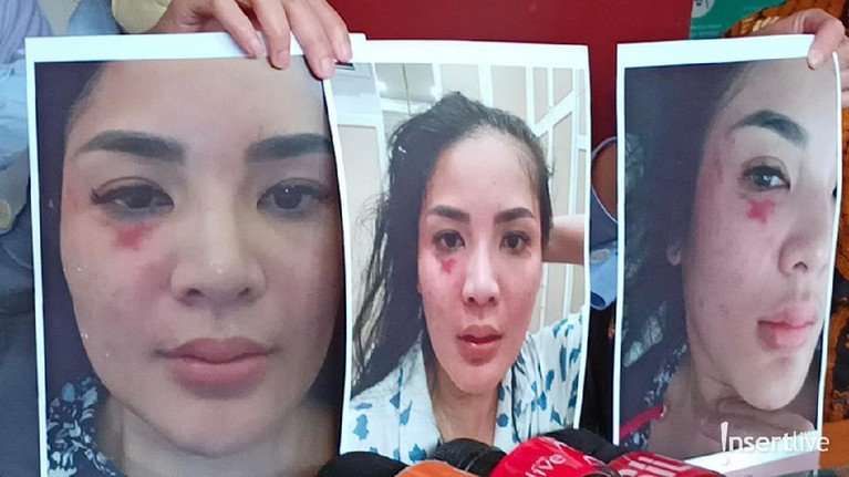 Nindy Ayunda Nindy Ayunda