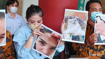 Tulis Pesan Penuh Isyarat, Nindy Ayunda Siap Maafkan Sang Suami?