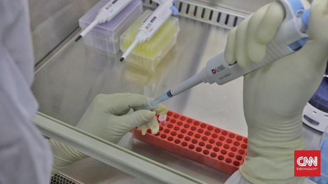 Menkes Budi Gunadi Sadikin menjelaskan inovasi penggunaan metode PCR dan USG untuk lebih cepat dalam deteksi penyakit tuberkulosis atau TBC.