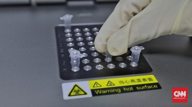 Jubir Satgas menyatakan nantinya metode tes yang tengah dikembangkan akan sejajar dengan PCR dan TCM dalam mengenali risiko terinfeksi virus corona.