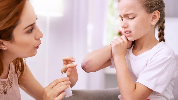 Loving mother. Nice pleasant woman looking at her daughters bruise while applying ointment on it
