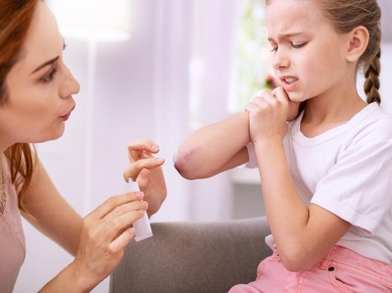 5 Obat Alami untuk Atasi Luka Lecet pada Anak