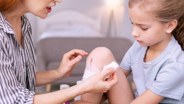OBAT ALAMI ATASI LUKA LECET