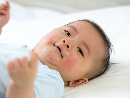 10 Tips Mencegah Bayi Alami Ruam Kulit Saat Musim Hujan