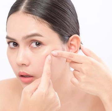 img-title Jerawat Selalu Muncul di Tempat yang Sama? Ini Penyebabnya!