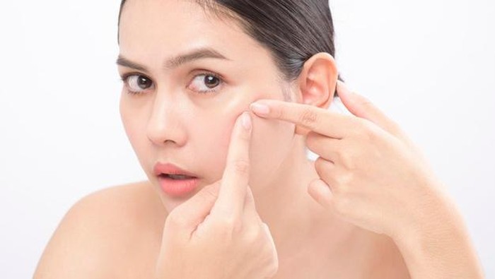 Jerawat Selalu Muncul di Tempat yang Sama? Ini Penyebabnya!