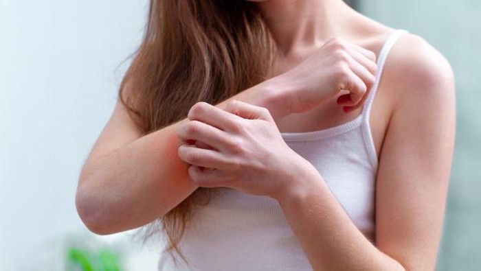 Makan Seafood Bikin 'Auto' Biduran, Benar Nggak Sih? Ini Penjelasan dari Sisi Medis