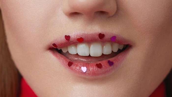 5 Cara Menyembuhkan Cold Sores karena Virus Herpes di Bibir
