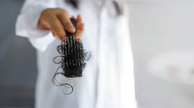 8 Makanan yang Menyebabkan Rambut Rontok, Ada yang Berprotein Sehat