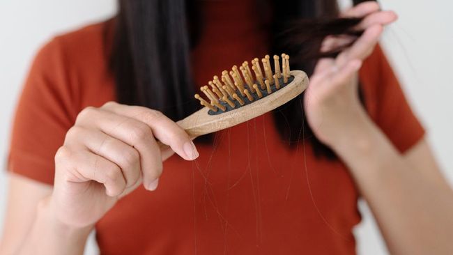 Banyak penyintas Covid-19 mengalami rambut rontok setelah terinfeksi virus corona. Terdapat sejumlah cara merawat rambut rontok pasca Covid.