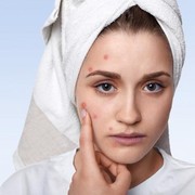 8 Do's and Don'ts Saat Kulit Wajah Sedang Berjerawat