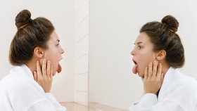Waspada Covid Tongue, Gejala Corona Seperti Sariawan