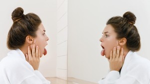 Waspada Covid Tongue, Gejala Corona Seperti Sariawan