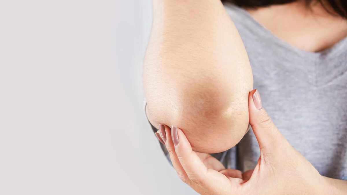 5 Cara Ampuh Memutihkan Siku agar Kulit Tak Tampak Belang