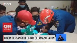 VIDEO: Cincin Tersangkut di Jari Selama 10 Tahun