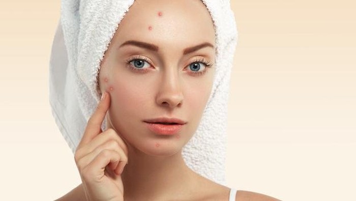 Rekomendasi 6 Acne Lotion Lokal dan Murah untuk Keringkan Jerawat dengan Cepat