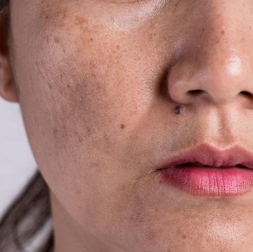 img-title Hati-hati! Ini Deretan Skincare Berbahaya yang Banyak Dijual di Pasaran